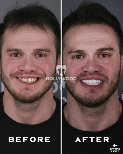 Slider image (1) Hollywood Dental Izmir Turkey